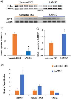 Intravenous administration of human amnion-derived mesenchymal stem cells improves gait and sensory function in mouse models of spinal cord injury